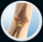 Elbow Fracture