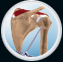 Rotator Cuff Tear