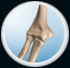 Tennis Elbow